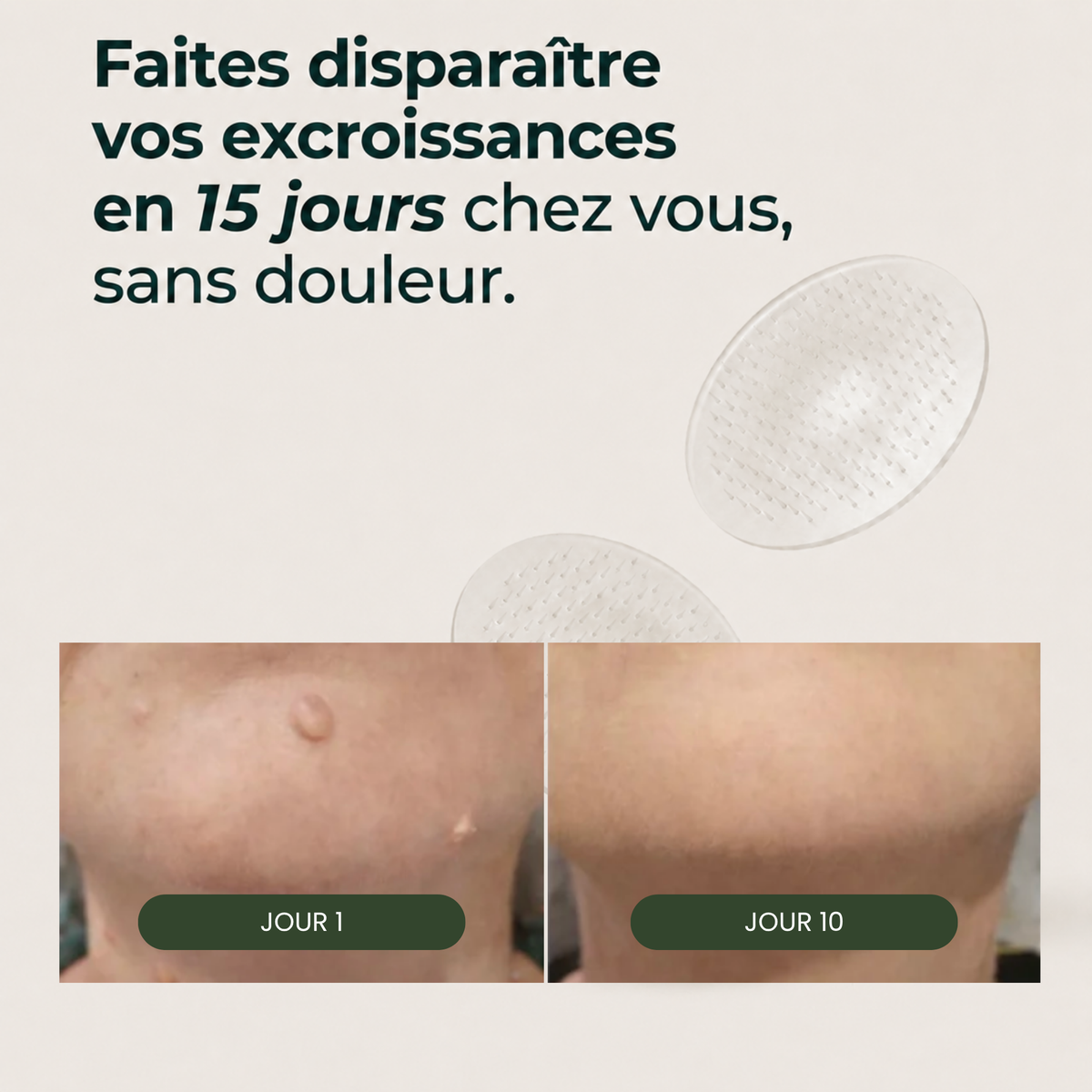 Patchs Dermo-Actifs Nouvelle Génération